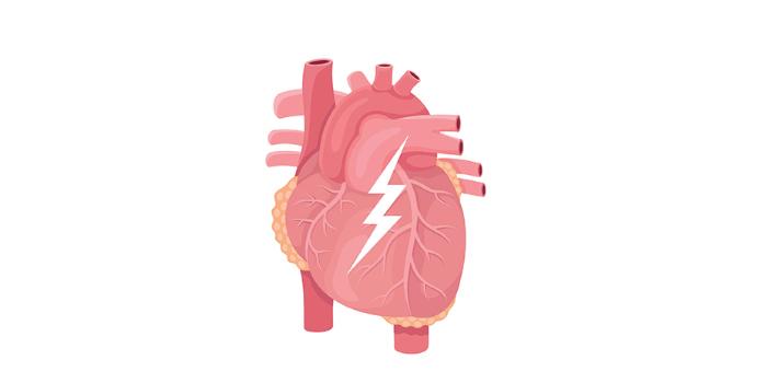 2. Mayor riesgo de enfermedad cardíaca y ataque cardíaco: la obesidad contribuye a la presión arterial alta, el colesterol y el azúcar en la sangre, lo que puede endurecer las arterias y aumentar el riesgo de ataque cardíaco.